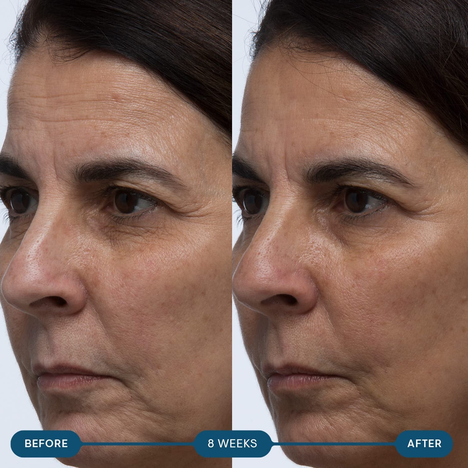 ELEMIS Pro-Collagen Skin Future Food Supplement 60 Capsules | Daily Skin Wellness from Within Support youthful, radiant skin from the inside out with ELEMIS Pro-Collagen Skin Future Food Supplement!