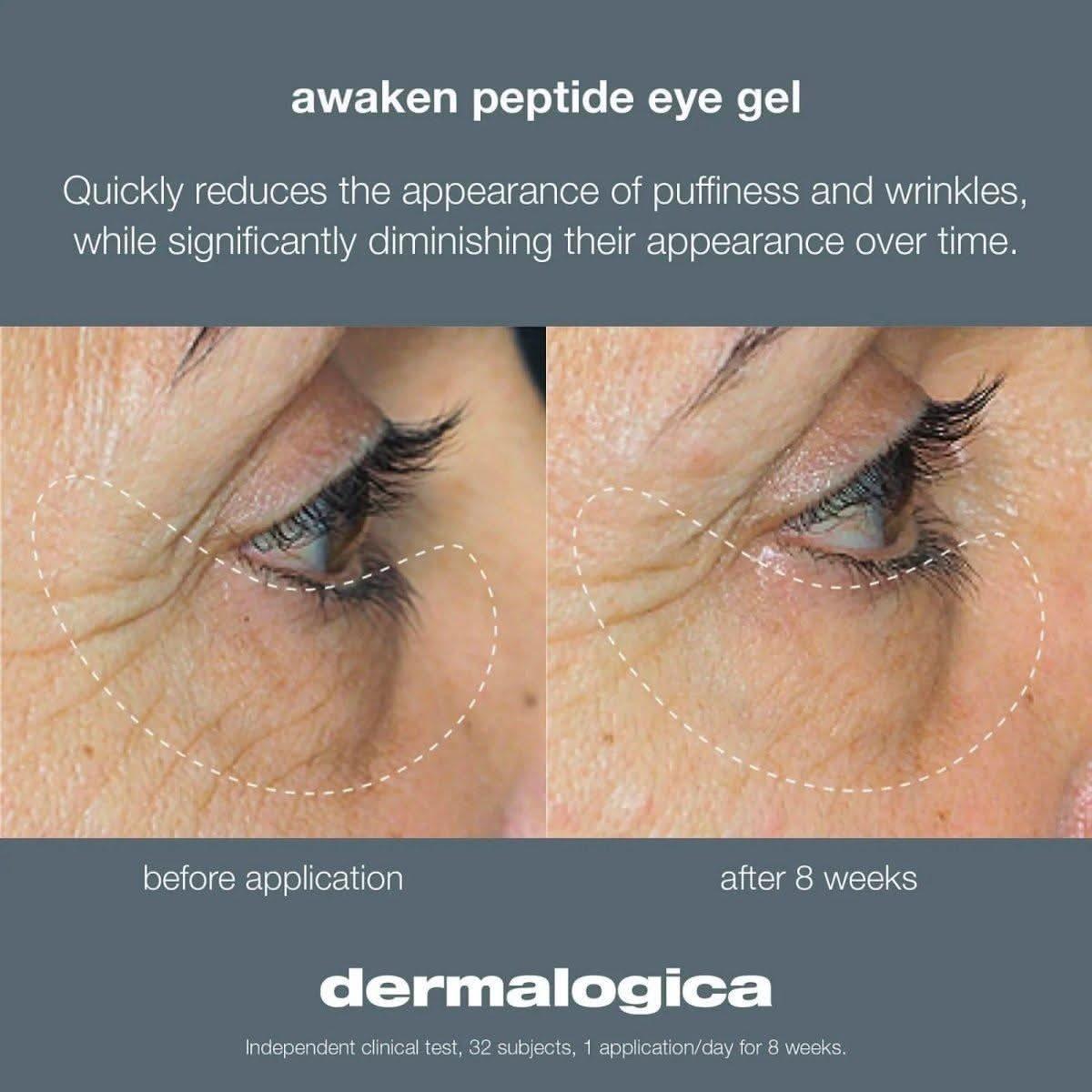 Dermalogica Awaken Peptide Eye Gel 15ml  | The 360¡ã Eye Revival Treatment for a Wide-Awake Look!