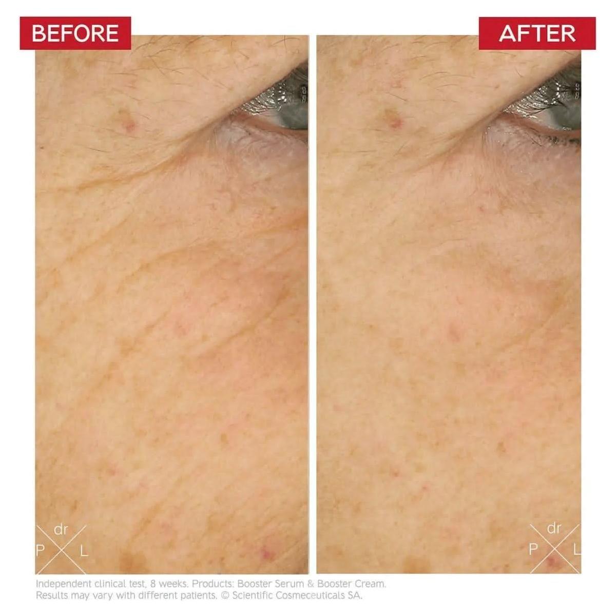 Dr. LEVY Switzerland Booster Cream | Stem Cell-Boosting Anti-Aging Treatment