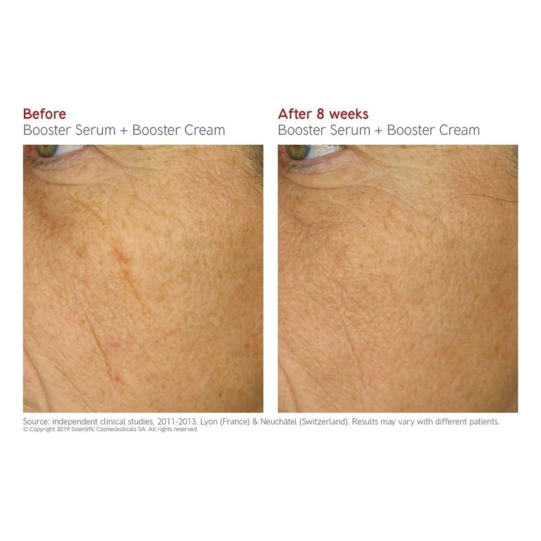 Dr. LEVY Switzerland Booster Cream | Stem Cell-Boosting Anti-Aging Treatment