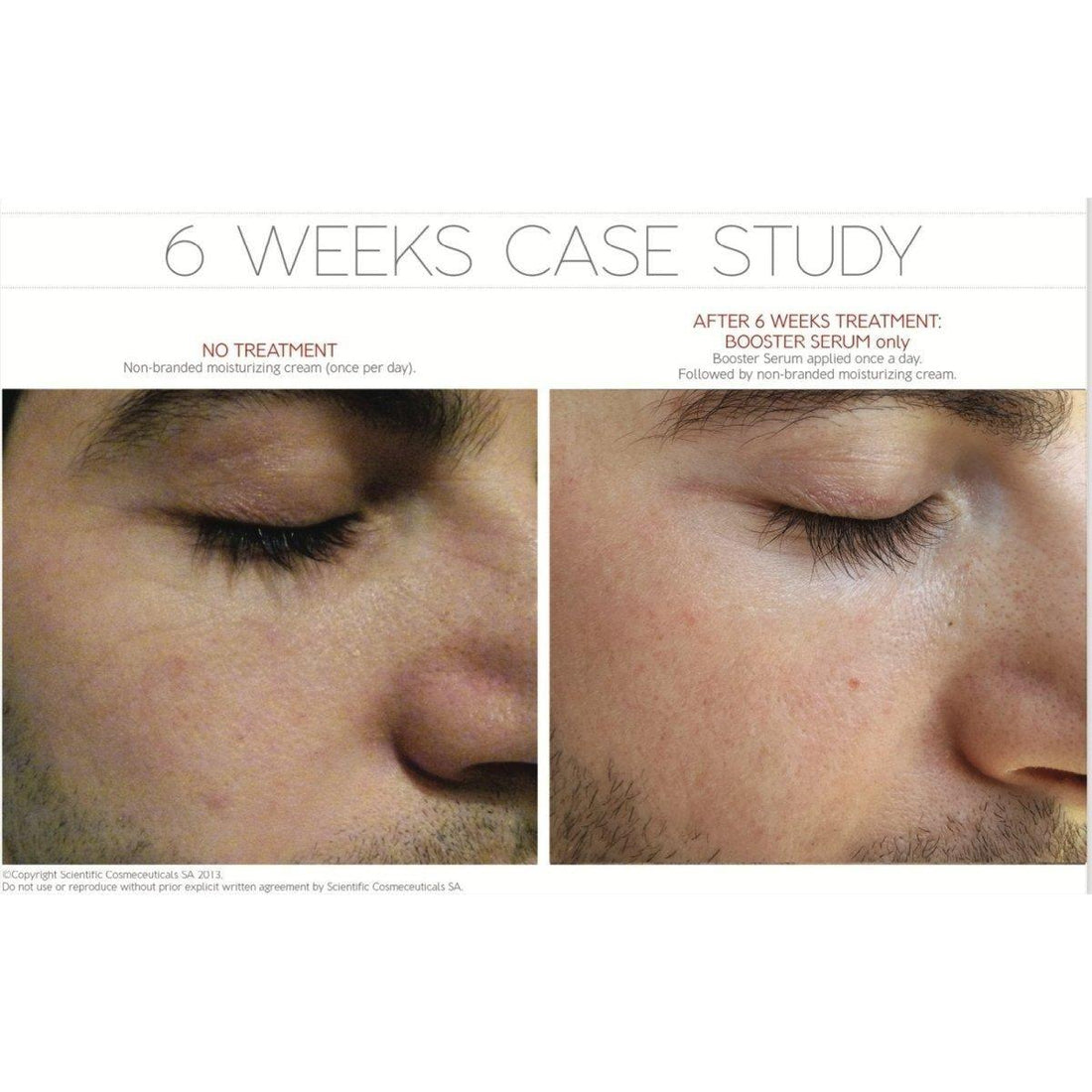 Dr. LEVY Switzerland Booster Serum 30ml | Advanced Anti-Aging Stem Cell Technology