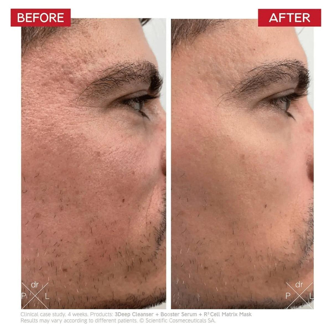 Dr. LEVY Switzerland Booster Serum 30ml | Advanced Anti-Aging Stem Cell Technology