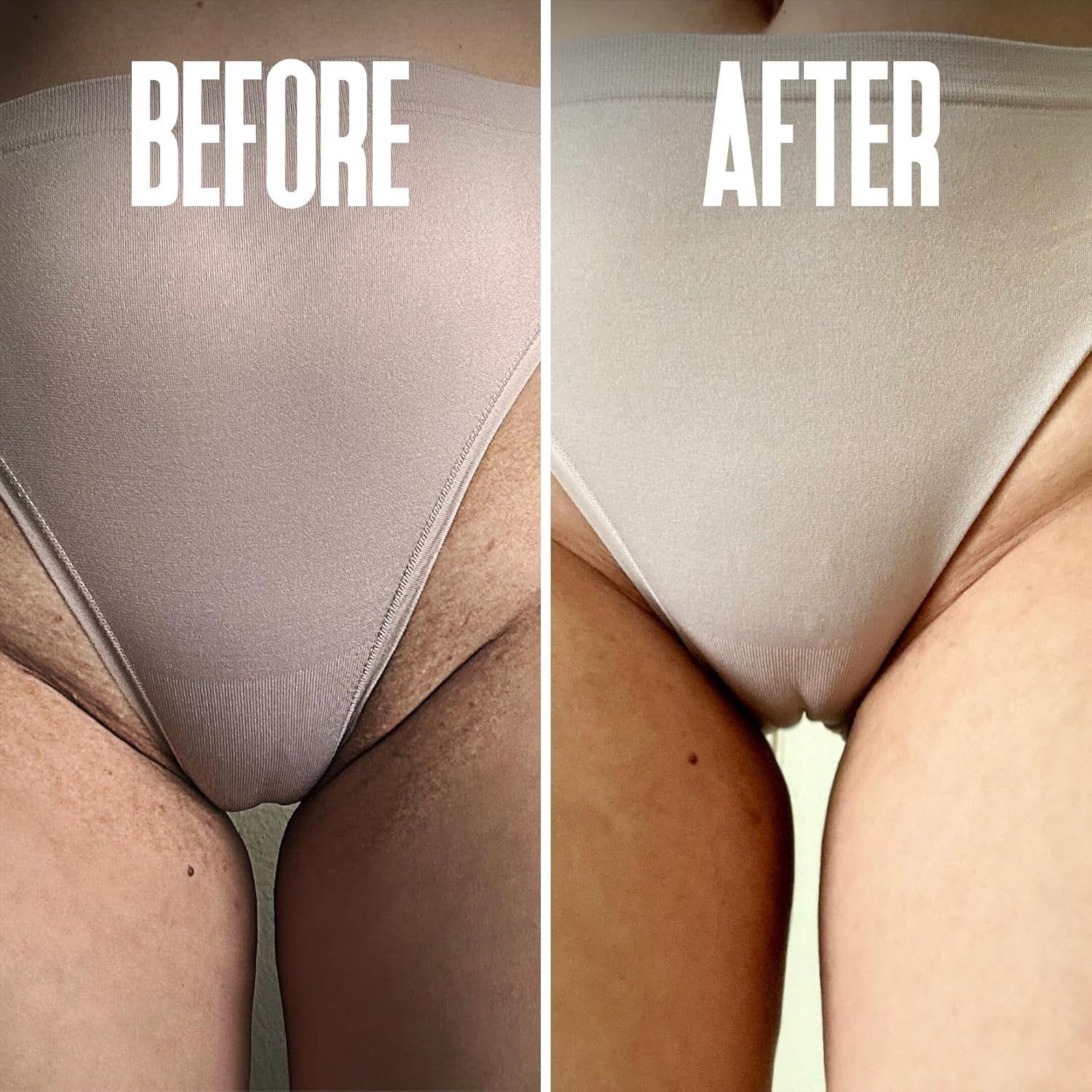 Divine Derriere Ingrown Hair Pads - 50 Pads | Exfoliating Razor Bump & Ingrown Hair Treatment