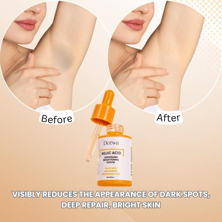Deewa Kojic Acid Underarm Brightening Serum - 30ml | Fade Dark Spots on Underarms, Knees & Elbows