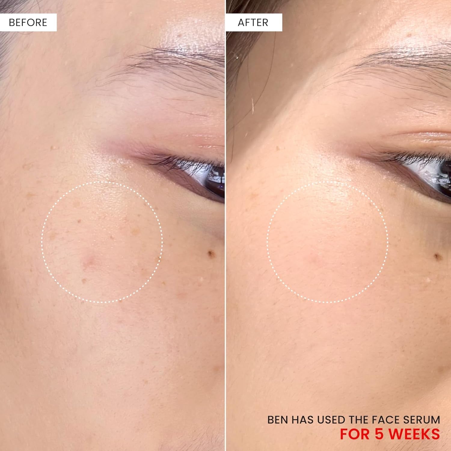 Koji White Kojic Dipalmitate + Tranexamic Acid Dark Spot Serum 30 ml | Brightens, Evens Skin Tone & Smooths Texture