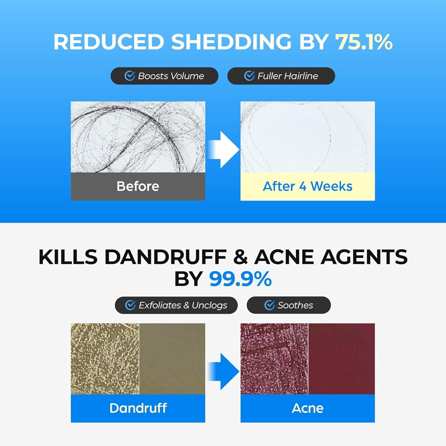 Seapuri Scalpy Bubble Tonic – 100ml | Reduces Hair Shedding, Dandruff & Boosts Root Volume