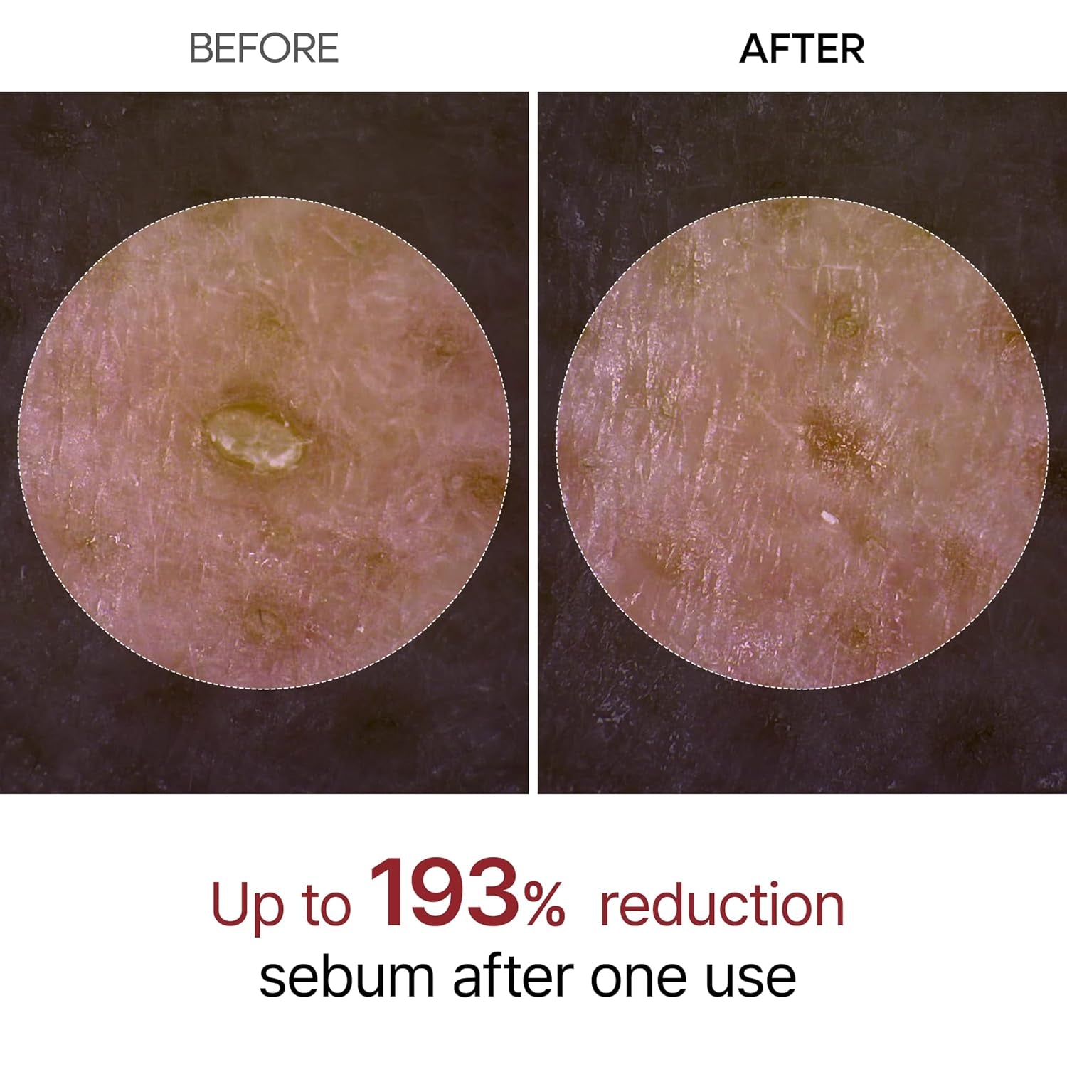 Dr.Melaxin Peel Shot Exfoliant Black Rice Ampoule 80ml | 4-in-1 Exfoliating Glow Booster with Niacinamide & Black Rice