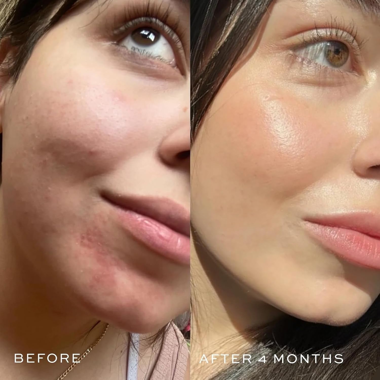 DIME Blue Facial Oil - 30ml | Calming Hydration & Blemish Relief with Blue Tansy & Rosehip