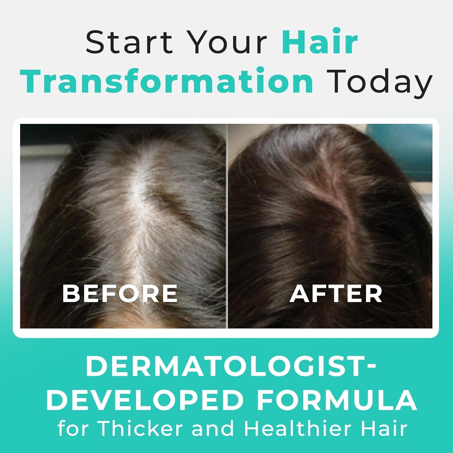 Hair Plus MD Hair Growth Supplement 120 Capsules | Clinically Proven Formula for Thicker, Fuller Hair