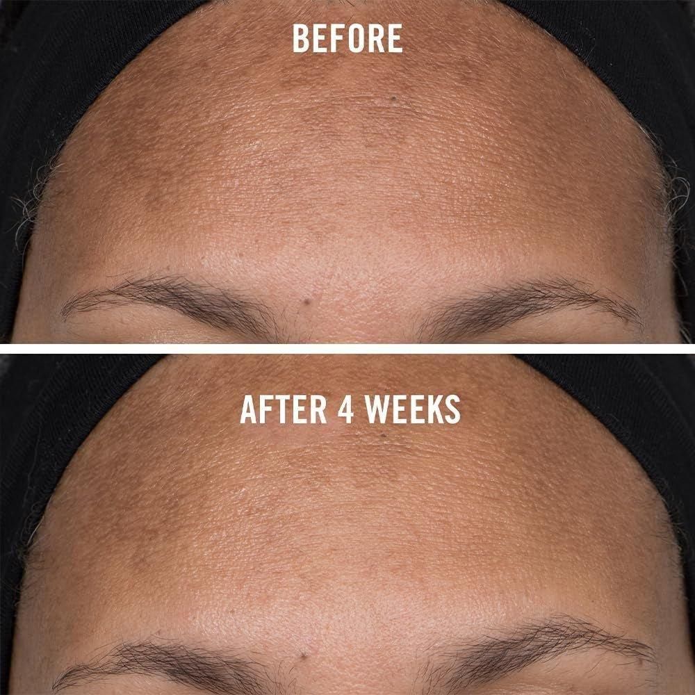 First Aid Beauty Niacinamide Dark Spot Serum: Your Brightening Boost for a Flawless Glow!