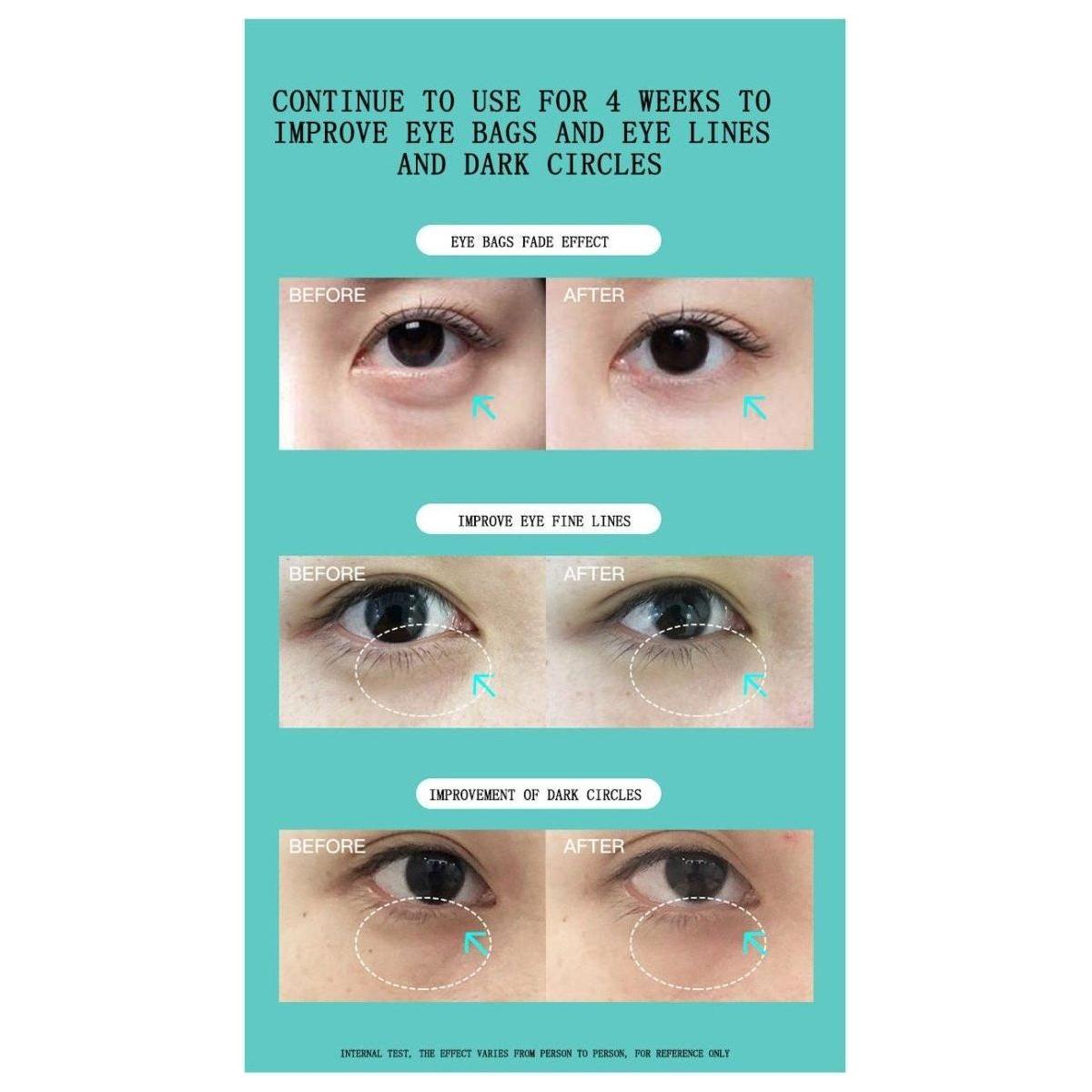 JUJY Pro iHero Eyes Care Massager | 24K Gold-Plated Eye Rejuvenation for Wrinkles, Puffiness & Dark Circles