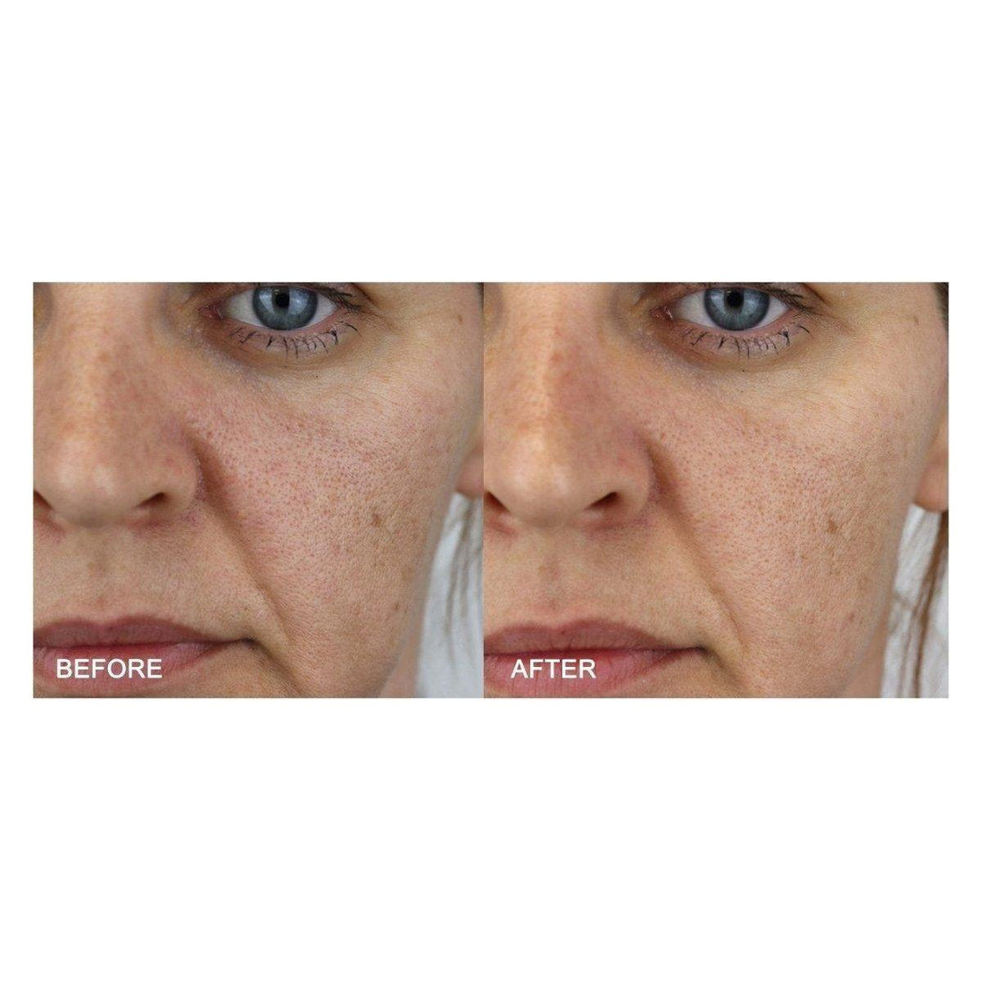 Medik8 Activated Charcoal Refining Mask Kit | Your At-Home Spa Detox!