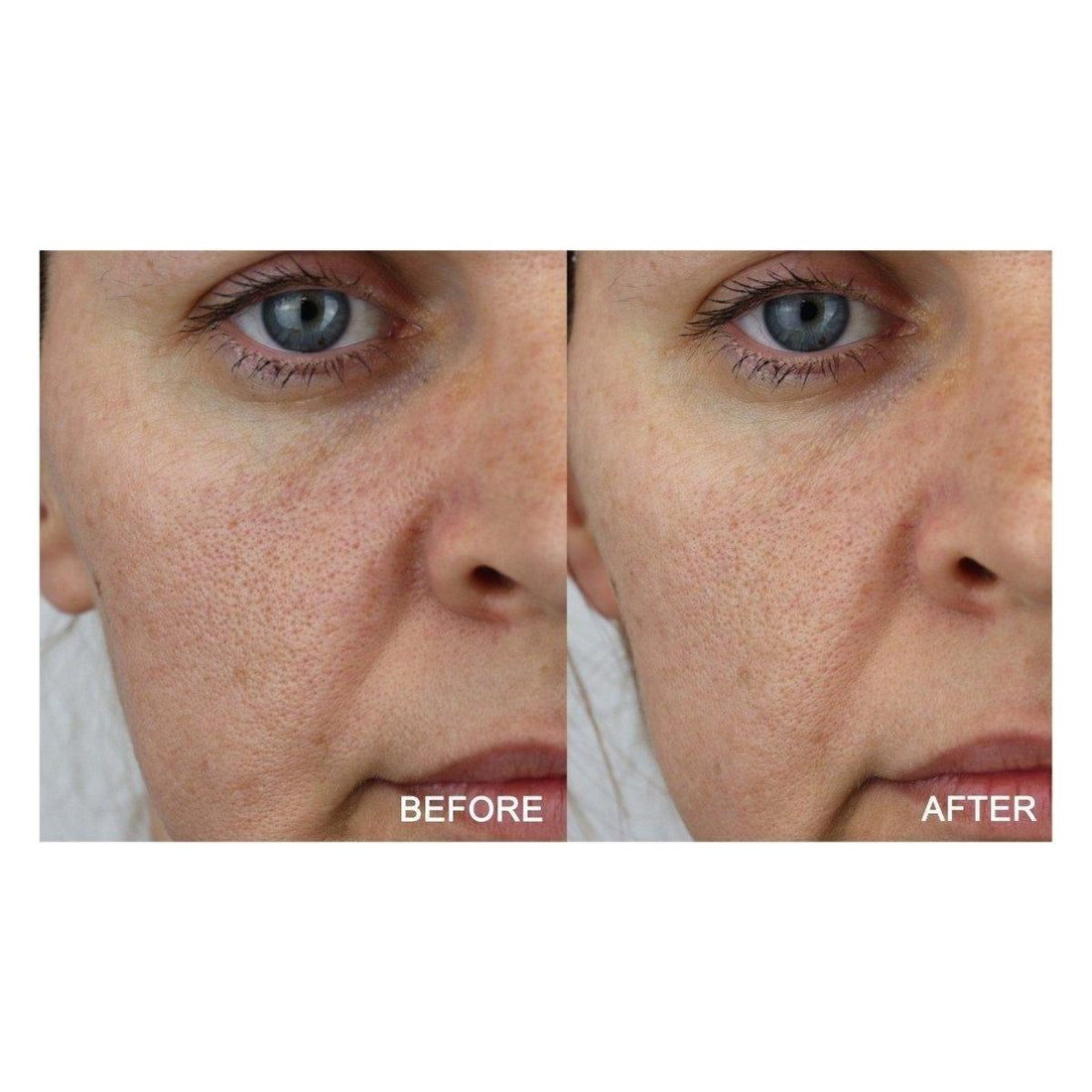 Medik8 Activated Charcoal Refining Mask Kit | Your At-Home Spa Detox!