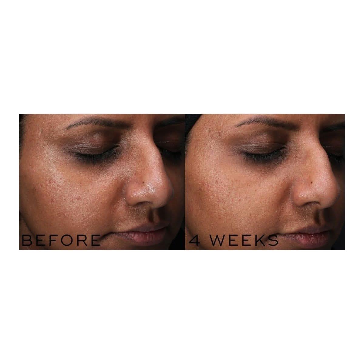 Medik8 Clarity Peptides | Your Glass Skin Secret is Here!