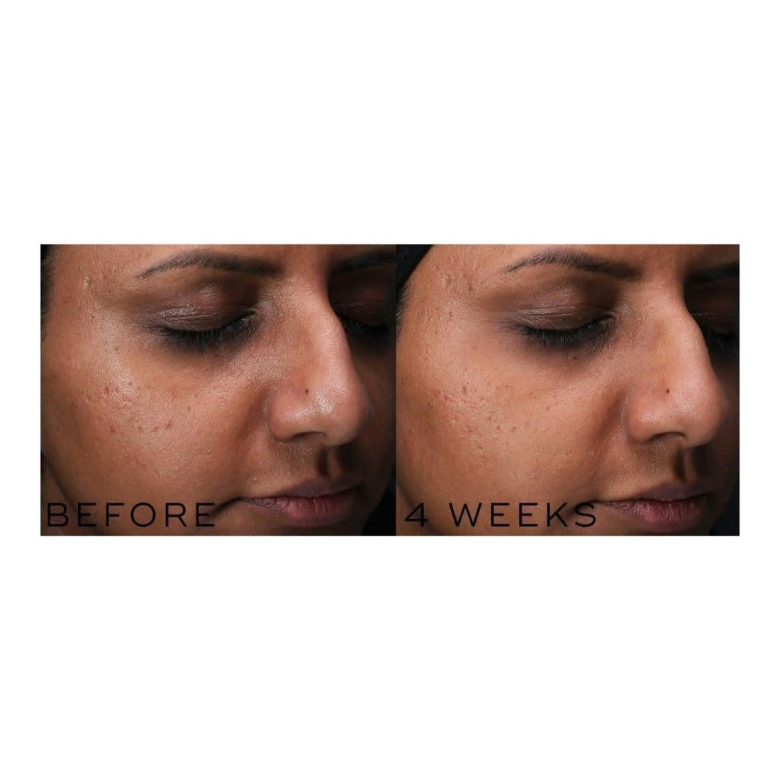 Medik8 Clarity Peptides | Your Glass Skin Secret is Here!