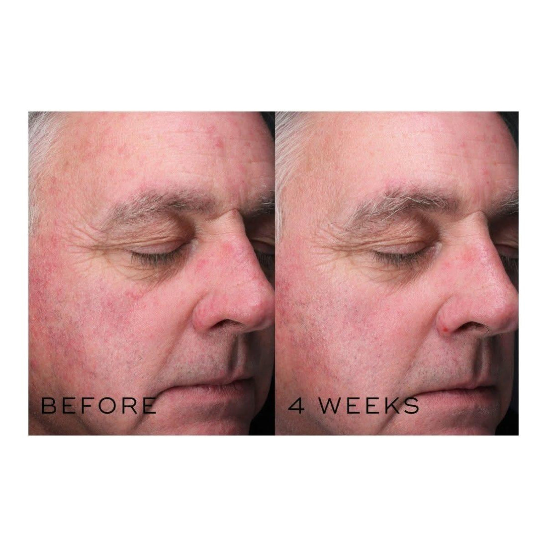 Medik8 Clarity Peptides | Your Glass Skin Secret is Here!