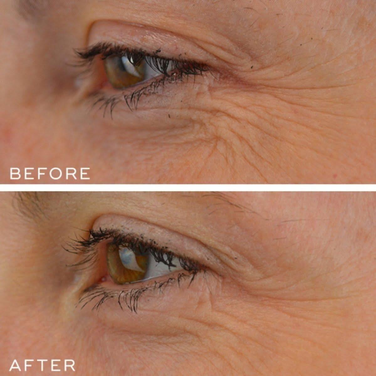 Medik8 Crystal Retinal 10 | The Non-Prescription Powerhouse for Dramatic Transformation!