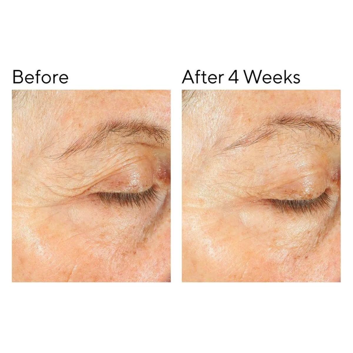 Murad Intense Recovery Cream 50ml | Ultra-Soothing Moisturiser for Stressed, Dry & Sensitive Skin Rescue & Restore: Deep Calm for Stressed, Reactive Skin!