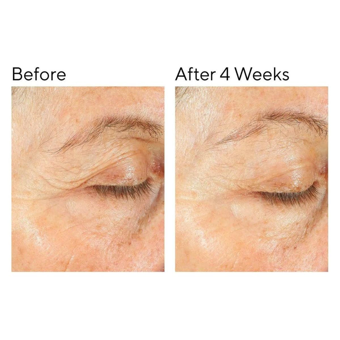 Murad Intense Recovery Cream 50ml | Ultra-Soothing Moisturiser for Stressed, Dry & Sensitive Skin Rescue & Restore: Deep Calm for Stressed, Reactive Skin!