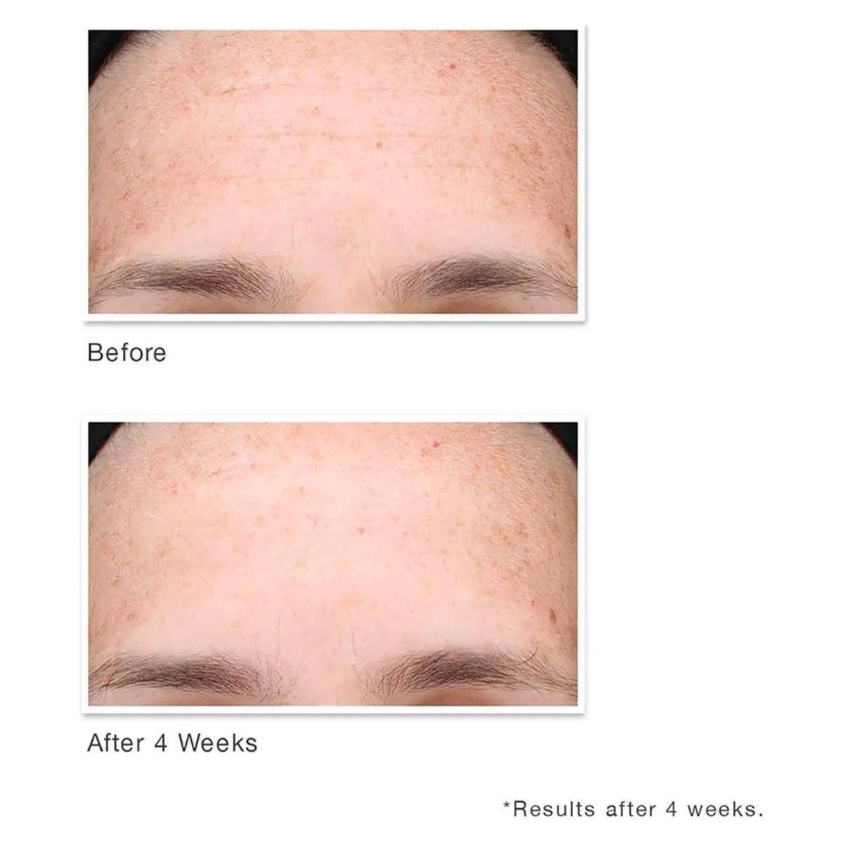 Murad Multi-Vitamin Infusion Oil 30ml | Vitamin-Powered Face Oil for Radiance, Hydration & Anti-Aging A to F Glow: 6 Vitamins, 1 Bottle, Endless Radiance!