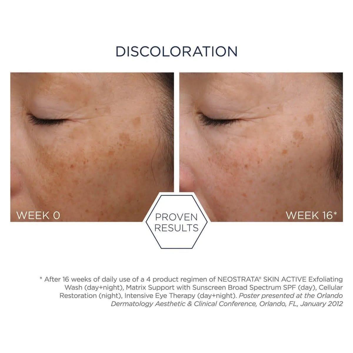 Neostrata Cellular Restoration 50ml Renew, Tone & Firm: The Ultimate Anti-Ageing Revival Cream