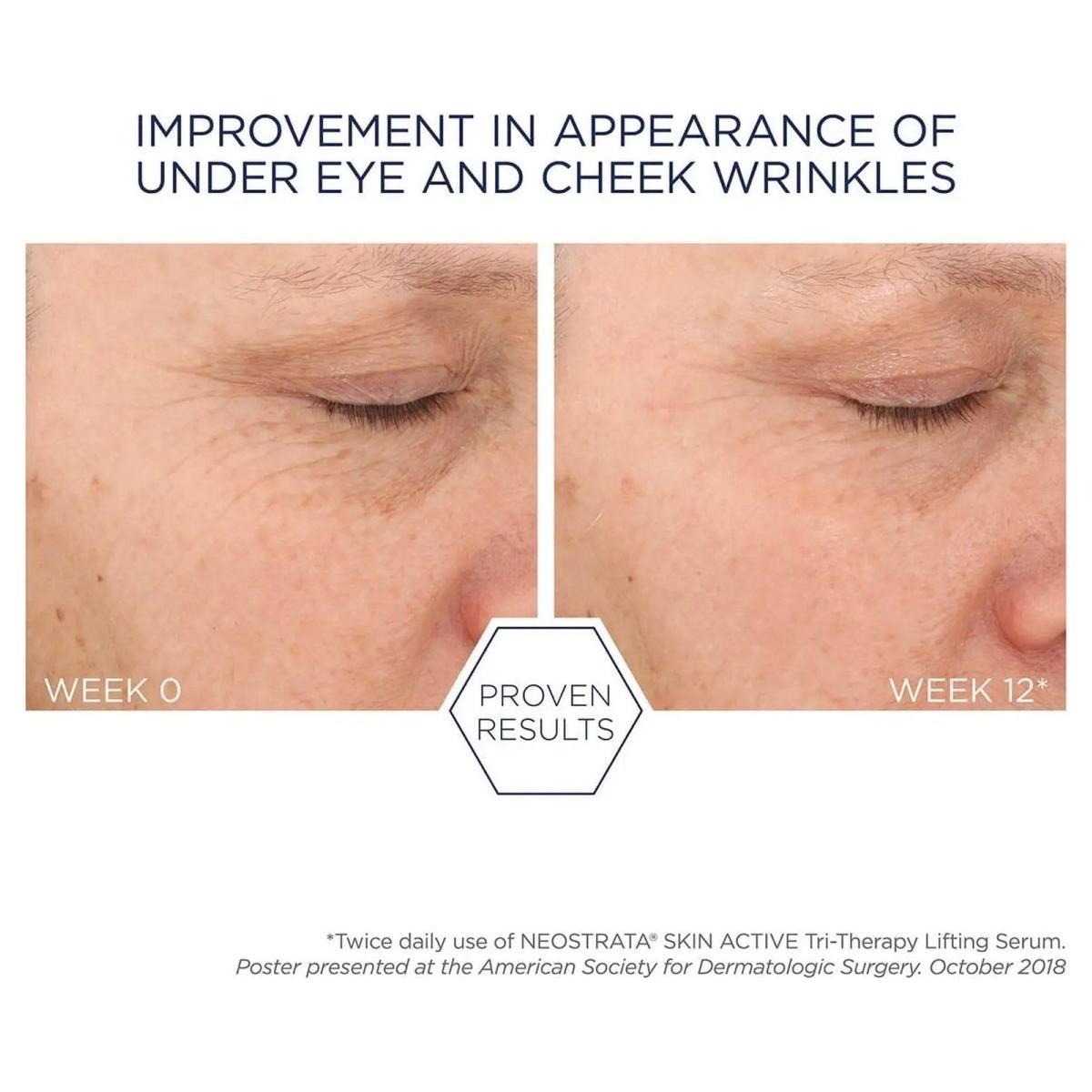 NeoStrata Tri-Therapy Lifting Serum | The Triple-Threat for Lifted, Plumper Skin!