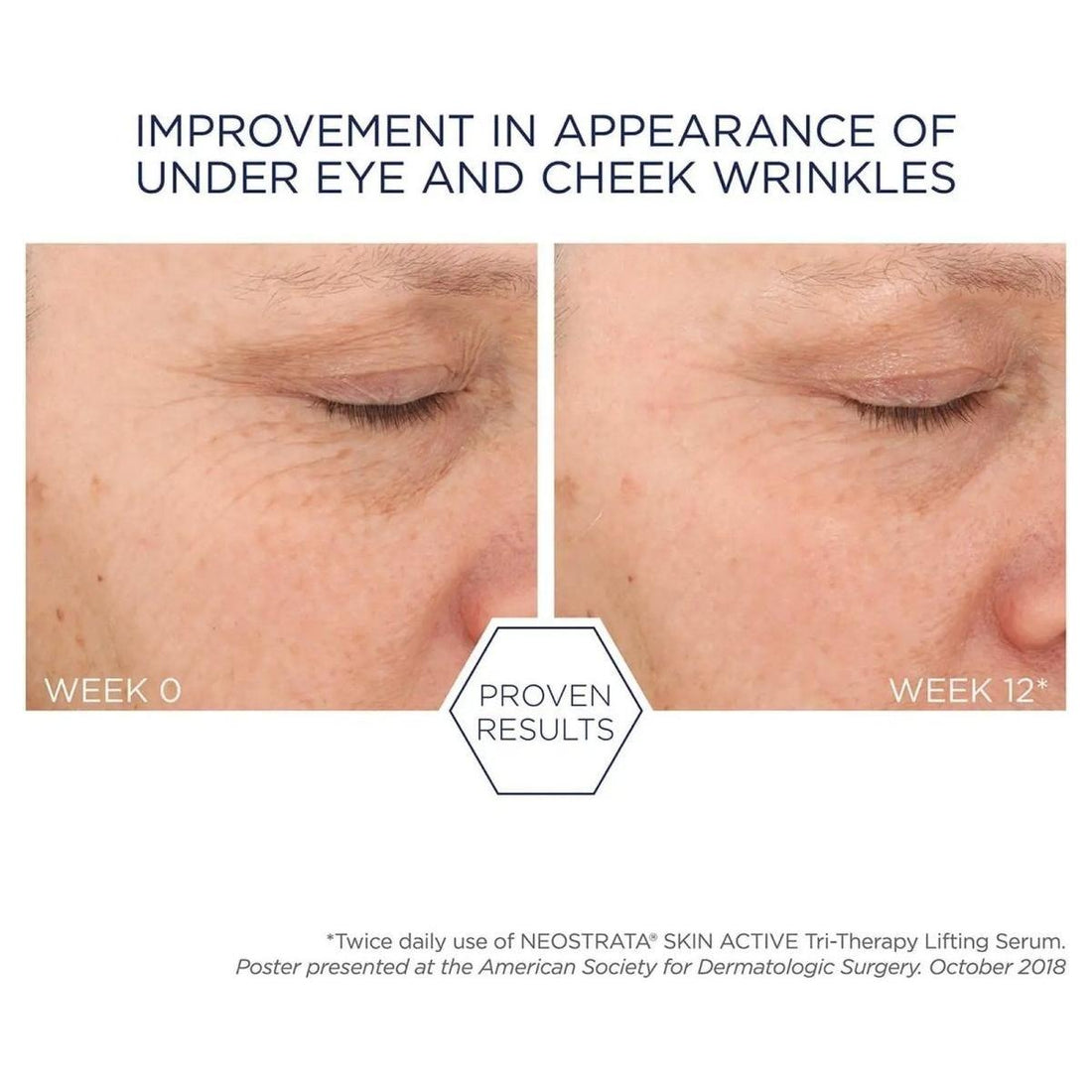 NeoStrata Tri-Therapy Lifting Serum | The Triple-Threat for Lifted, Plumper Skin!