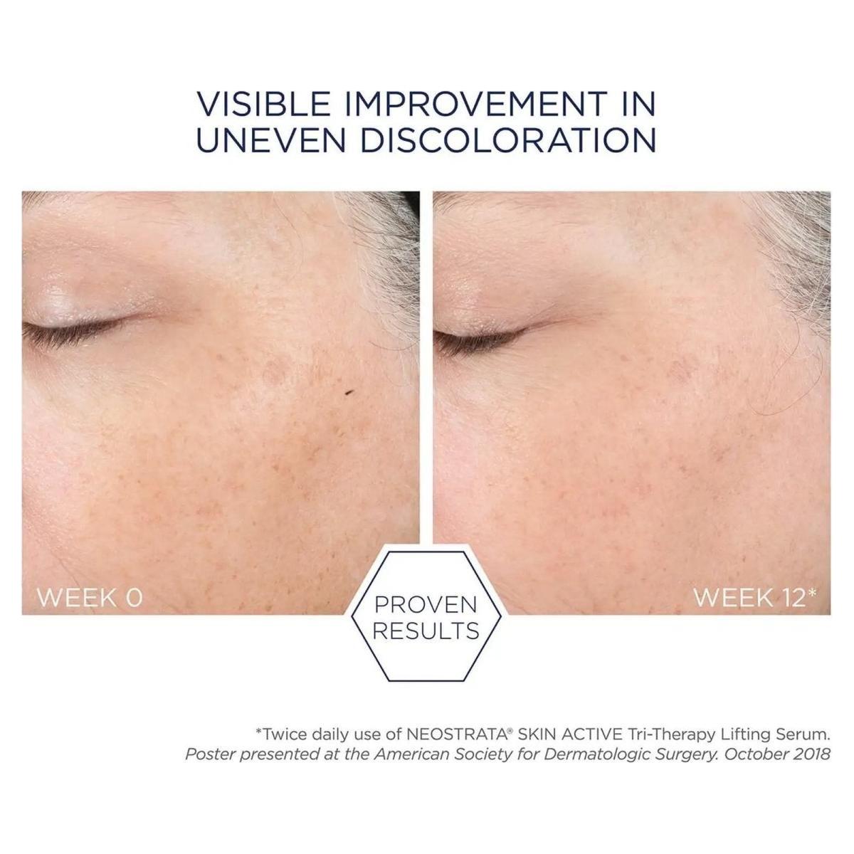 NeoStrata Tri-Therapy Lifting Serum | The Triple-Threat for Lifted, Plumper Skin!