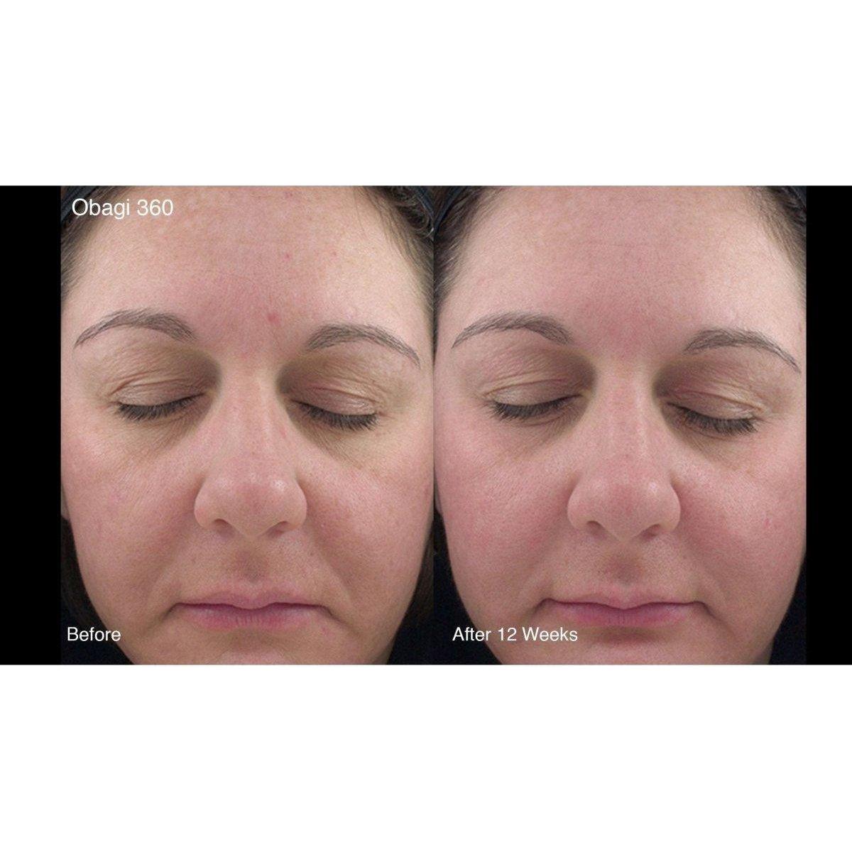 Obagi 360 Hydrafactor Moisturizer SPF30  | Daily Hydration with Broad Spectrum Protection