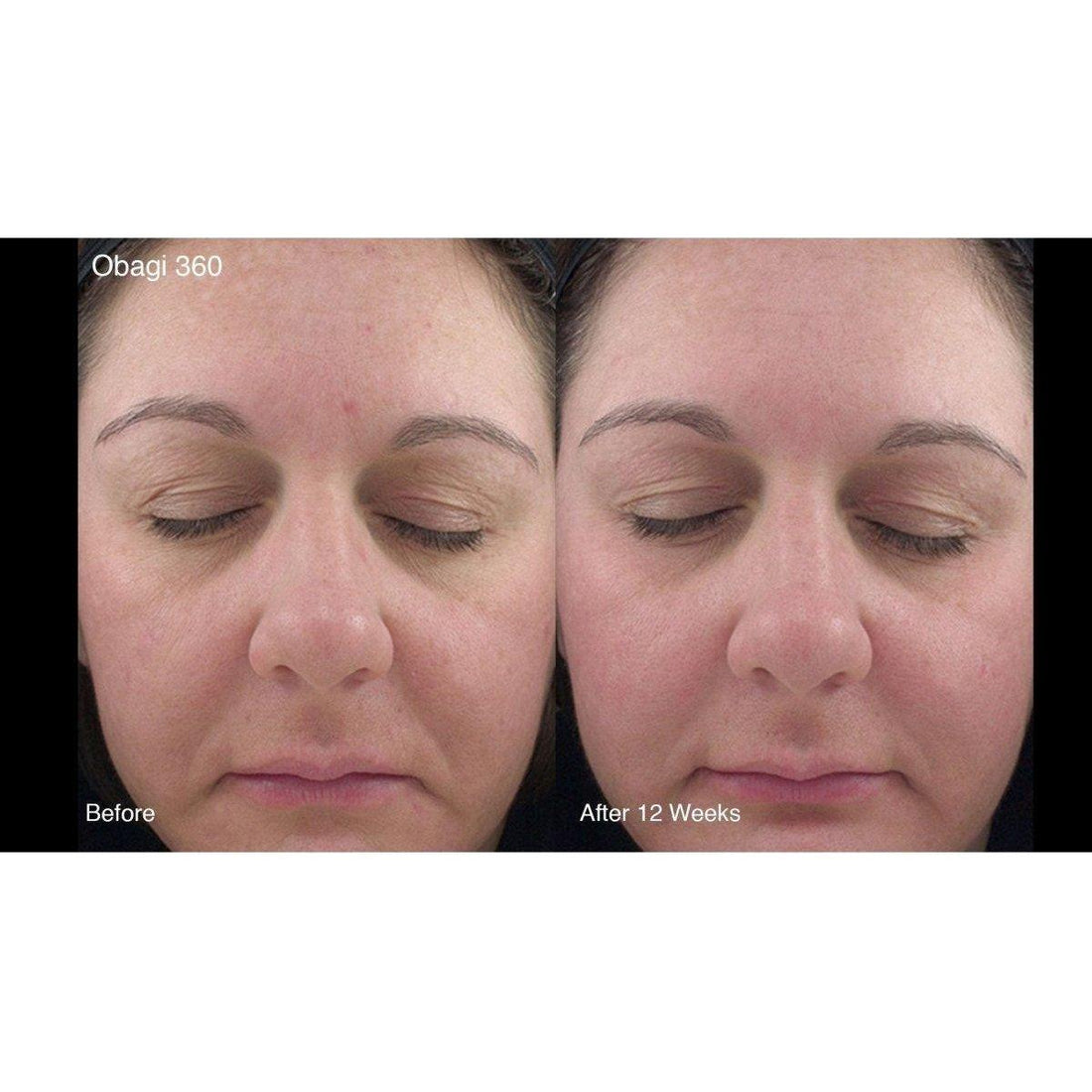 Obagi 360 Hydrafactor Moisturizer SPF30  | Daily Hydration with Broad Spectrum Protection