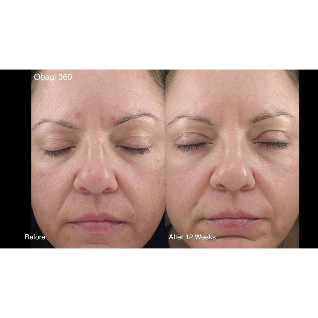 Obagi 360 Hydrafactor Moisturizer SPF30  | Daily Hydration with Broad Spectrum Protection