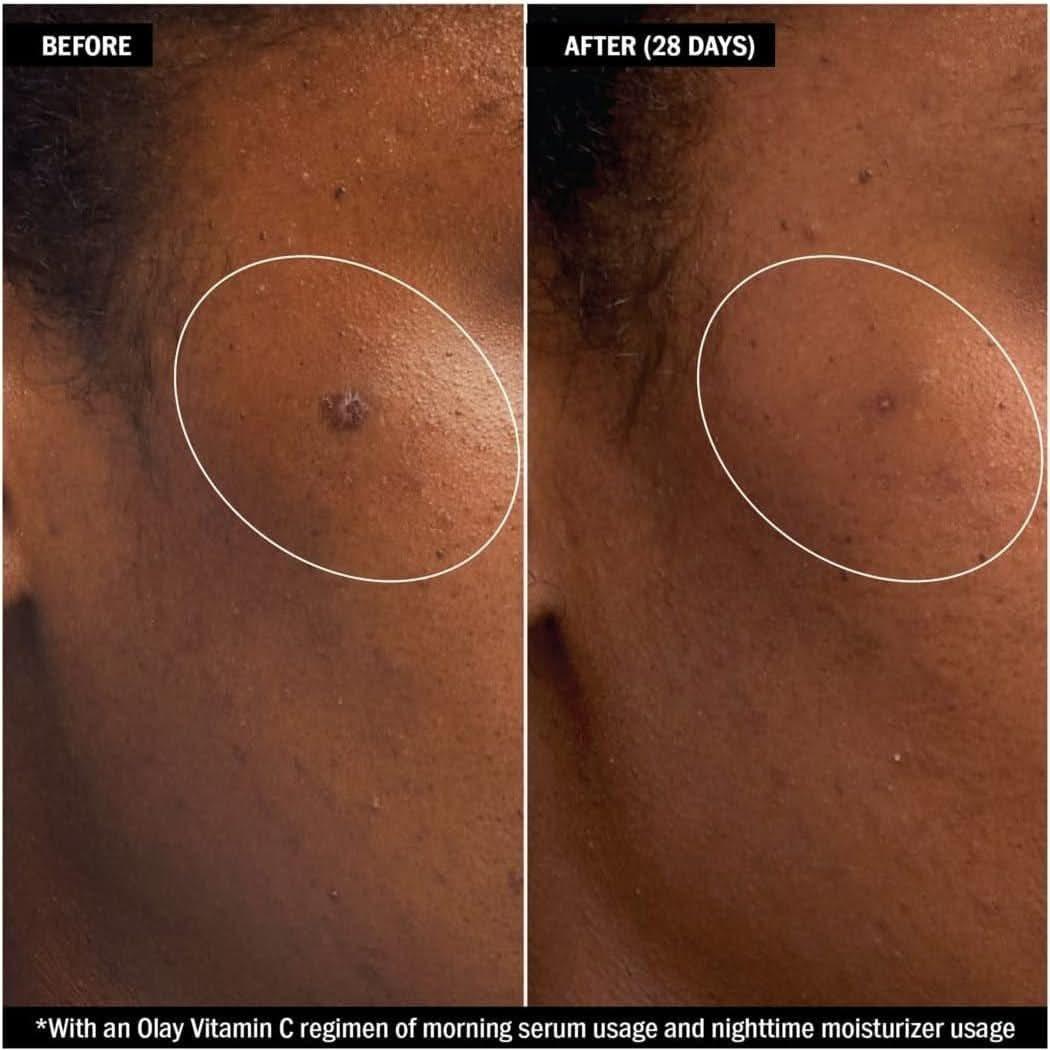 Olay Vitamin C + AHA24 Day Gel Serum 40ml | Brightening Serum with Niacinamide, AHA & Vitamin C