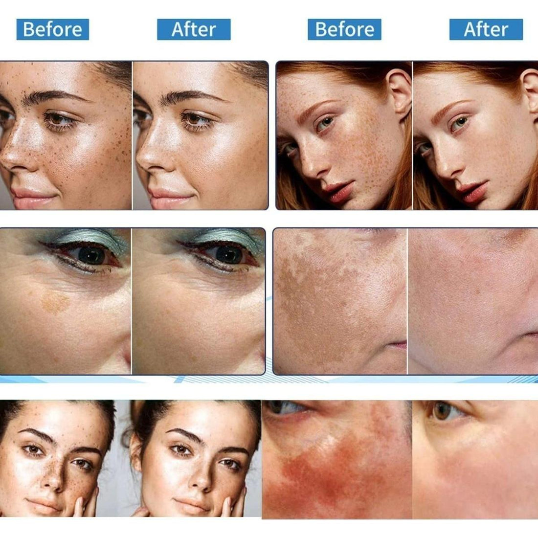 Paradise Emerald Dark Spot Corrector | Natural Brightening Cream for Hyperpigmentation, Melasma & Uneven Skin Tone Paradise Emerald