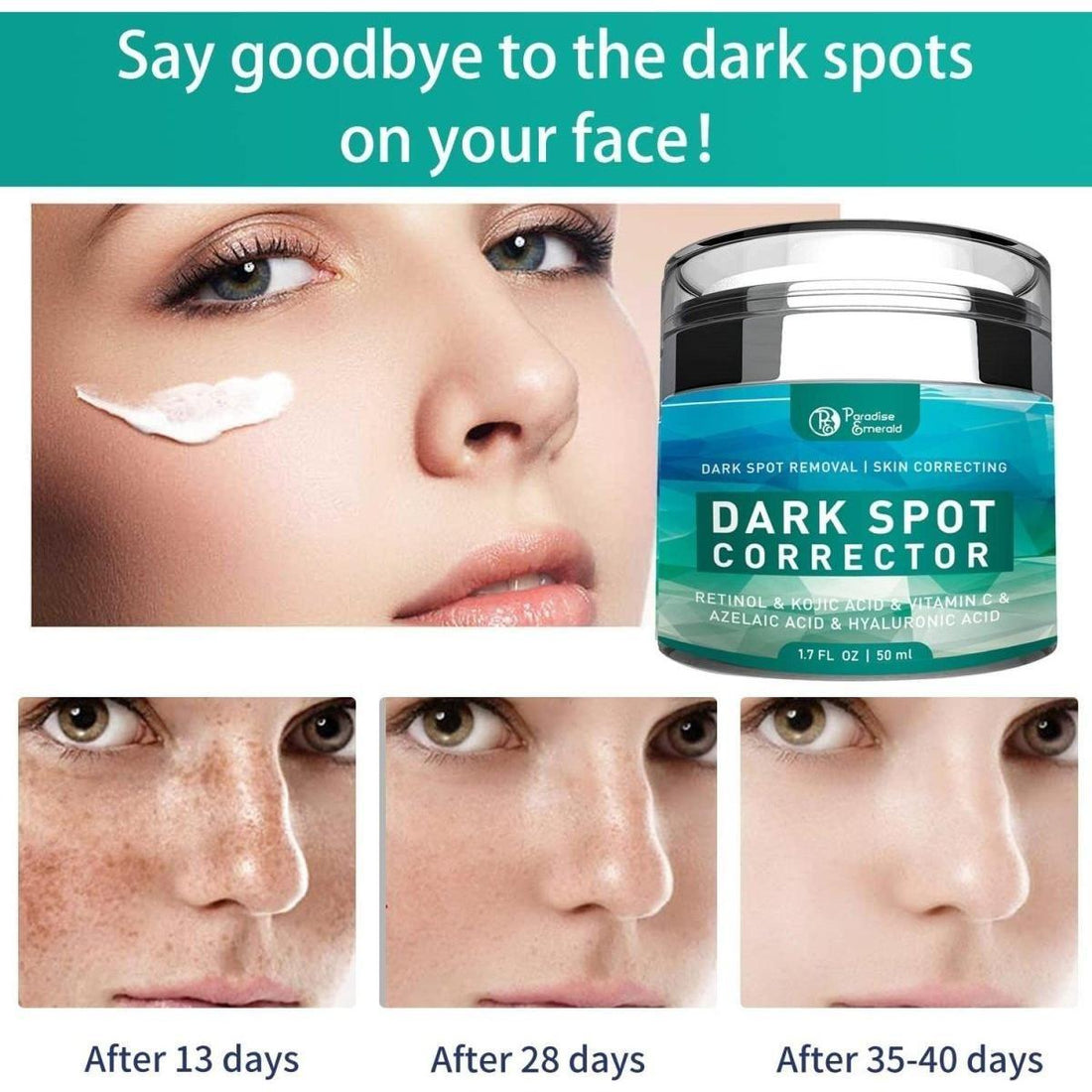 Paradise Emerald Dark Spot Corrector | Natural Brightening Cream for Hyperpigmentation, Melasma & Uneven Skin Tone Paradise Emerald