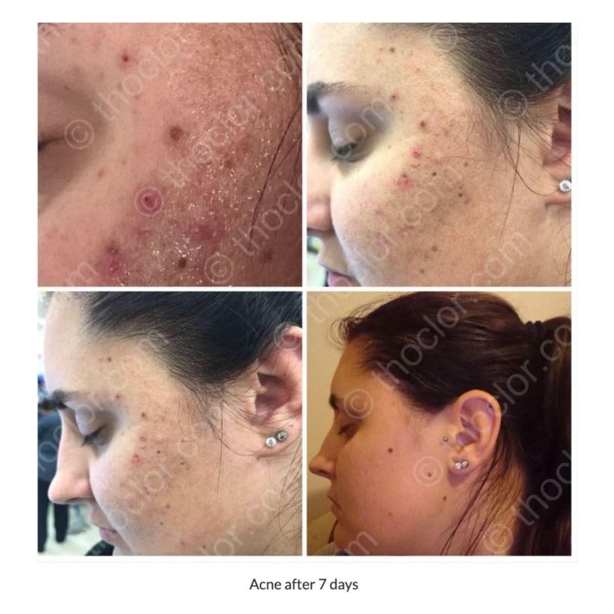 ThoClor Labs | GF2 Skin Rejuvenation | Your Skin's Daily Reset Button!