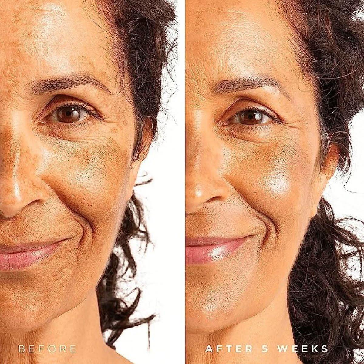 Tree of Life Niacinamide Serum (Vitamin B3) 60ml | Pore-Refining & Hydrating Formula