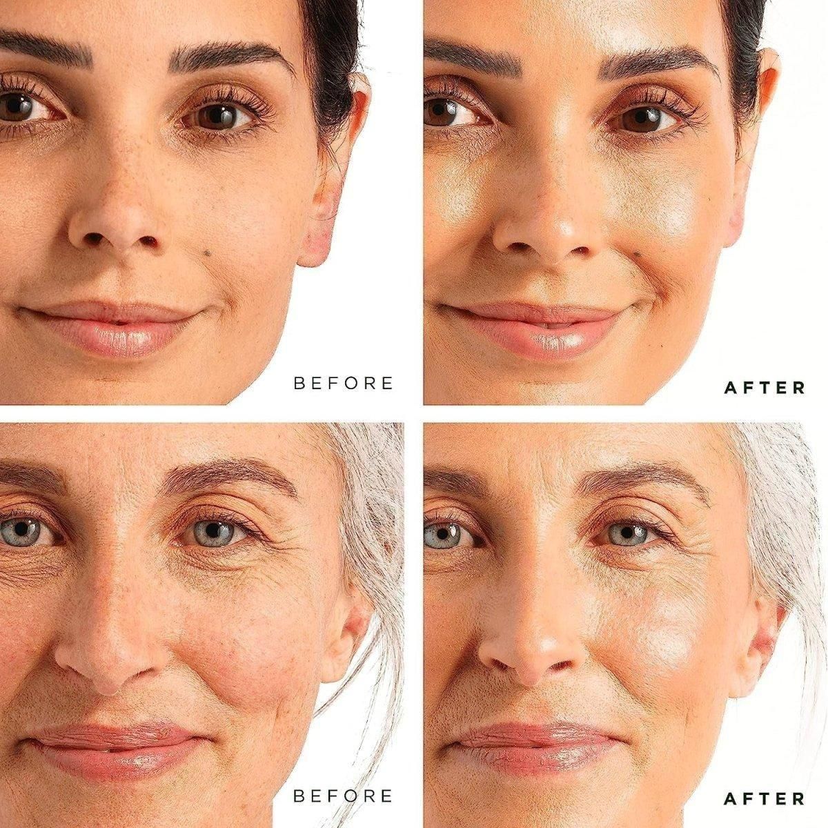 Tree of Life Vitamin C Brightening Serum & Retinol Firming Serum 2 Pack | AM & PM Duo for Radiance & Firmness Tree Of Life