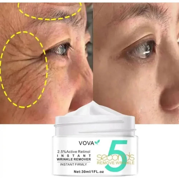 Vova Active Retinol Cream 30ml | Hydrating & Anti-Ageing Treatment